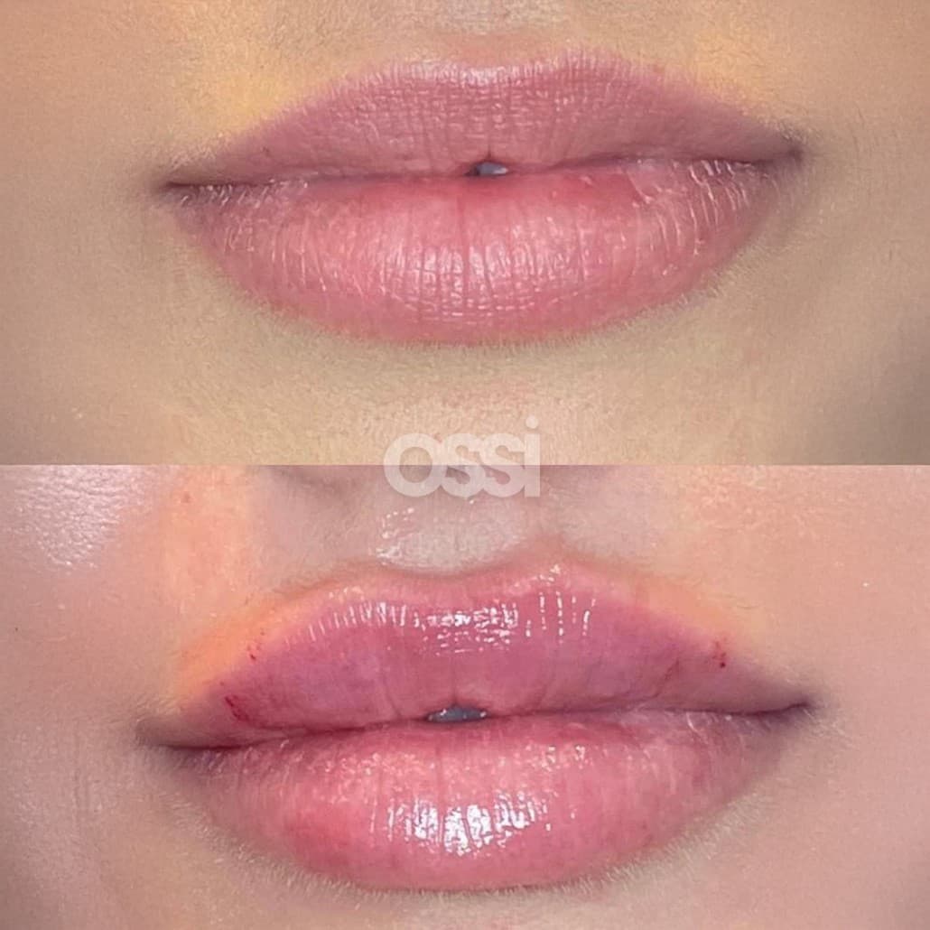 Filler Case 1