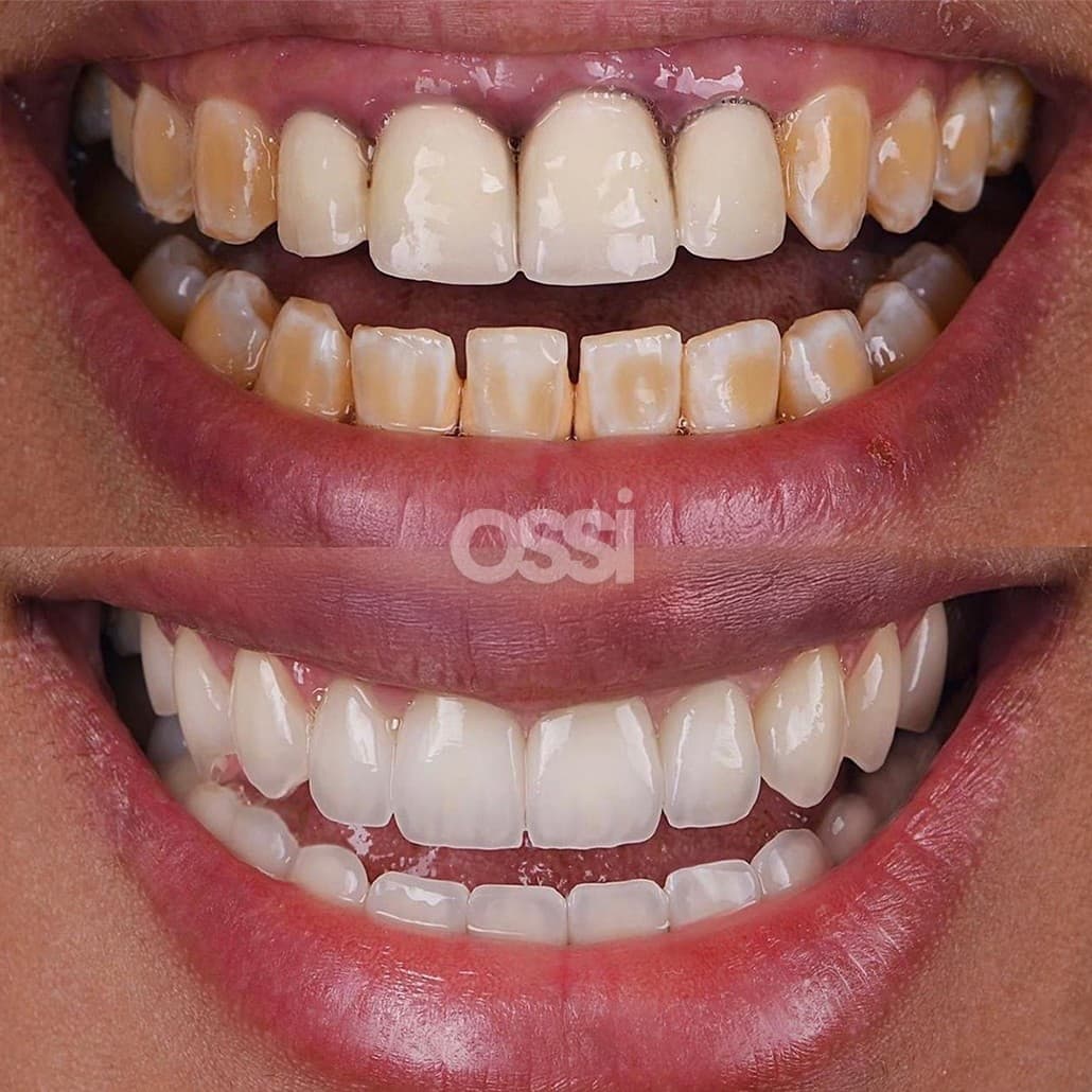 Dental Care Case 1