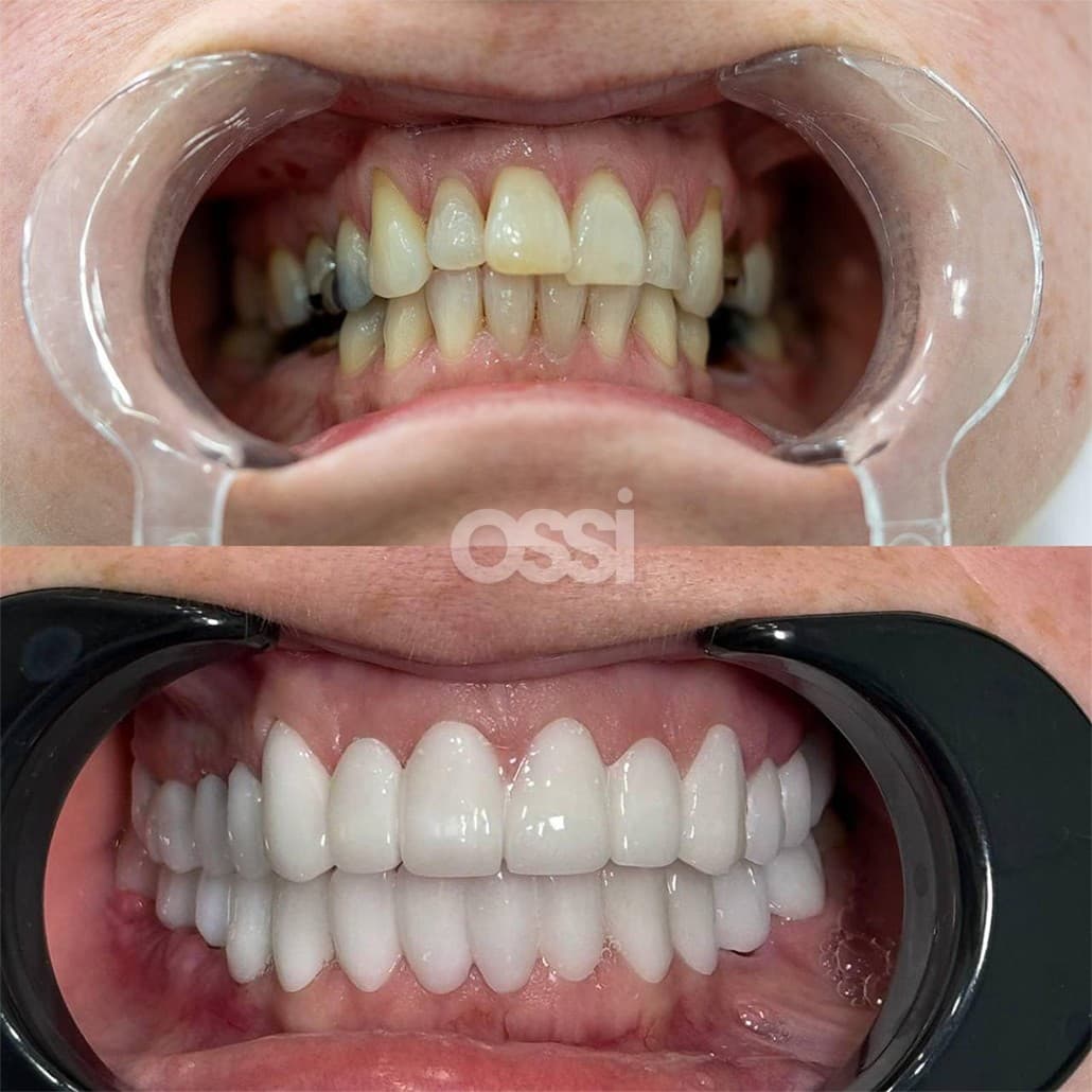 Dental Care Case 10