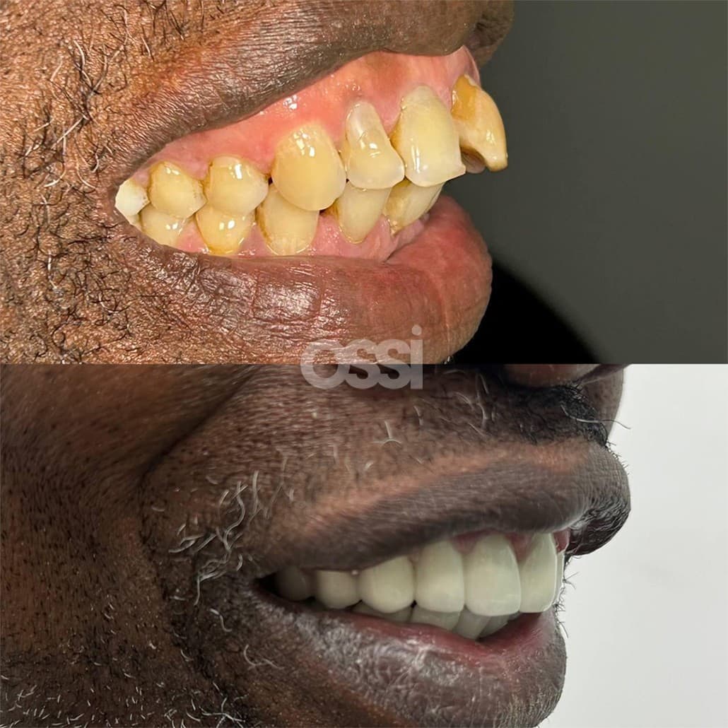 Dental Care Case 11