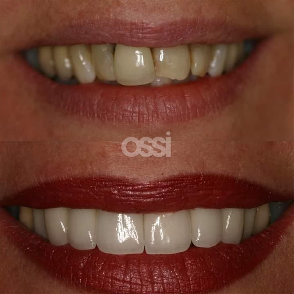 Dental Care Case 12