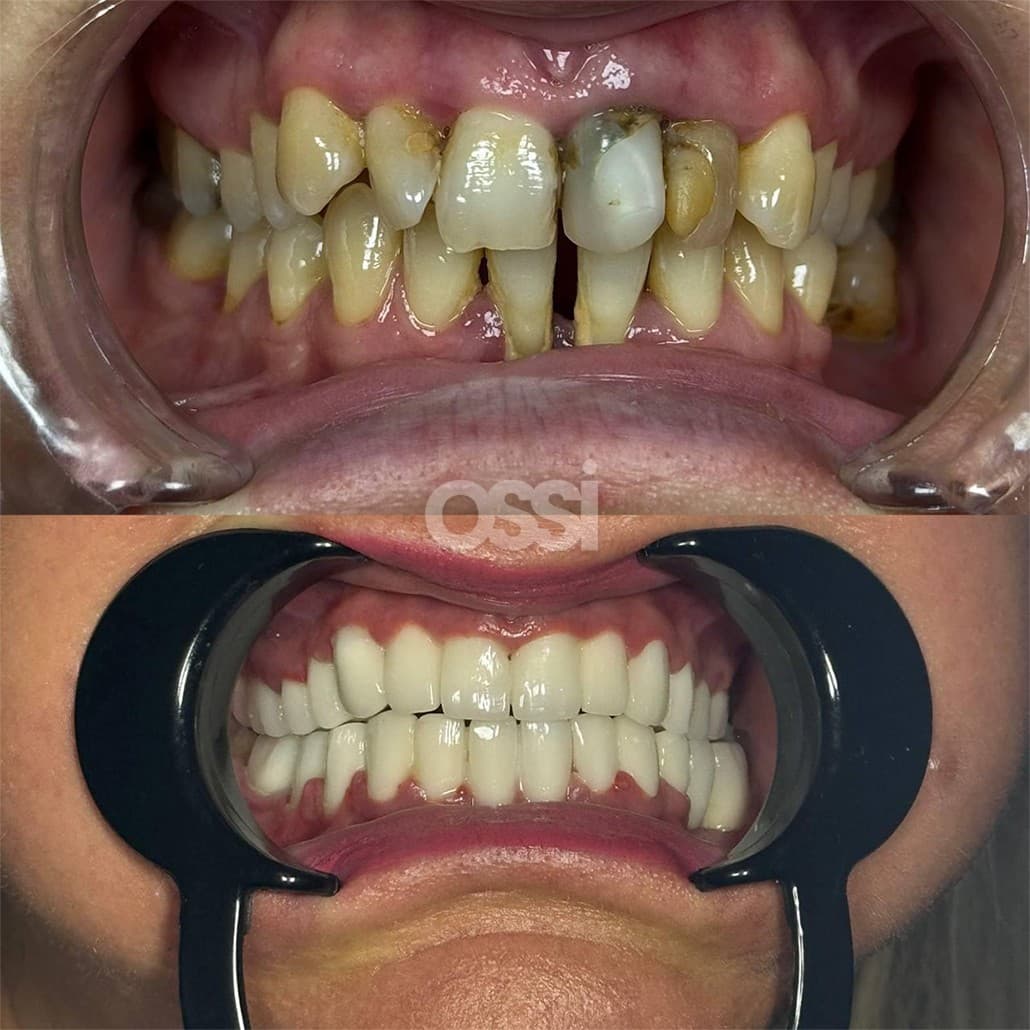 Dental Care Case 13