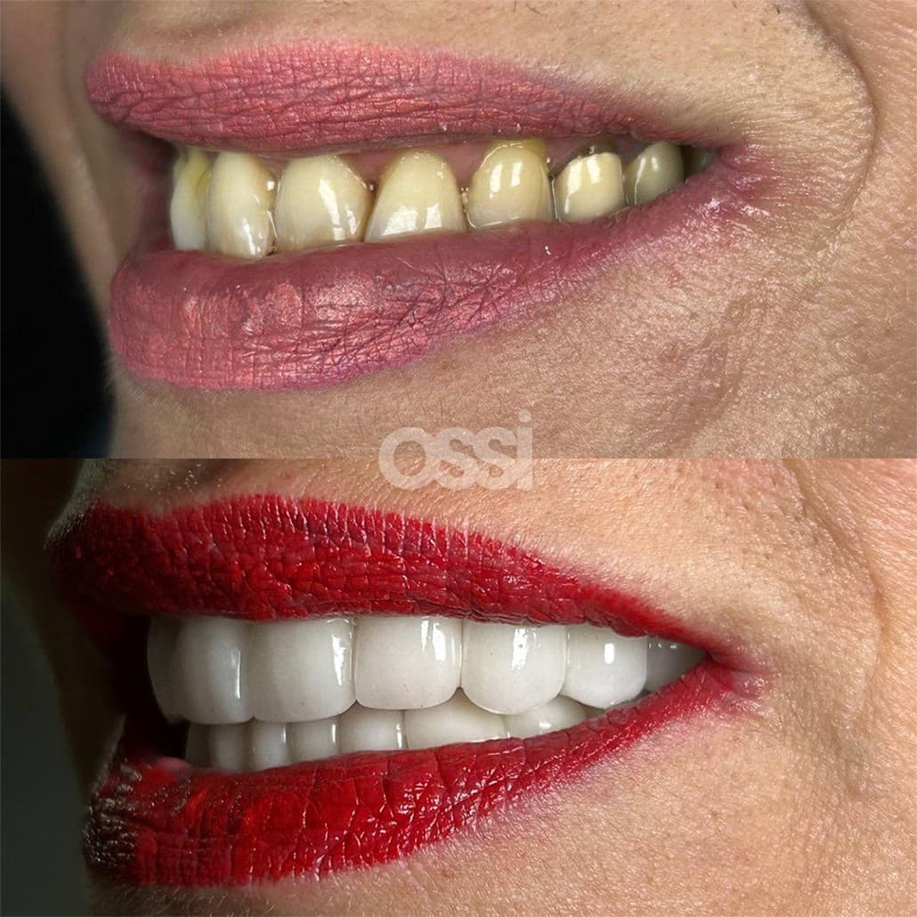 Dental Care Case 14