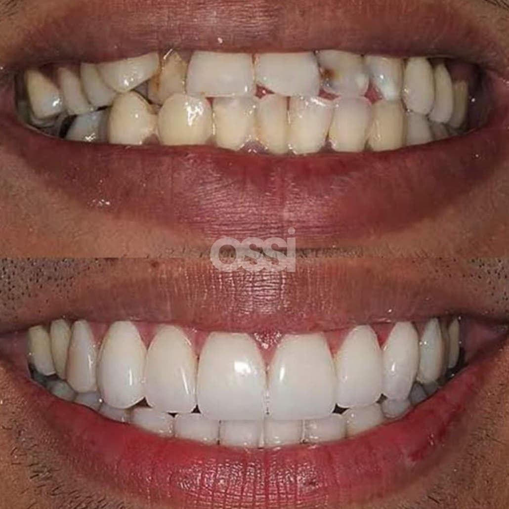 Dental Care Case 15