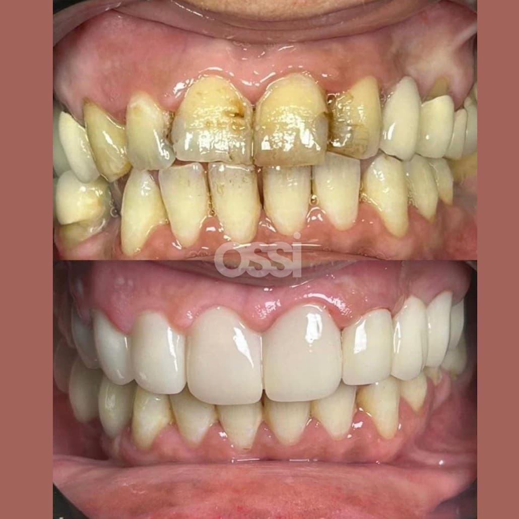 Dental Care Case 16
