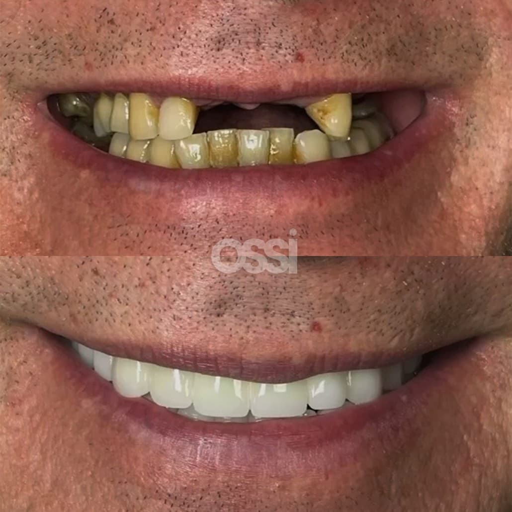 Dental Care Case 17