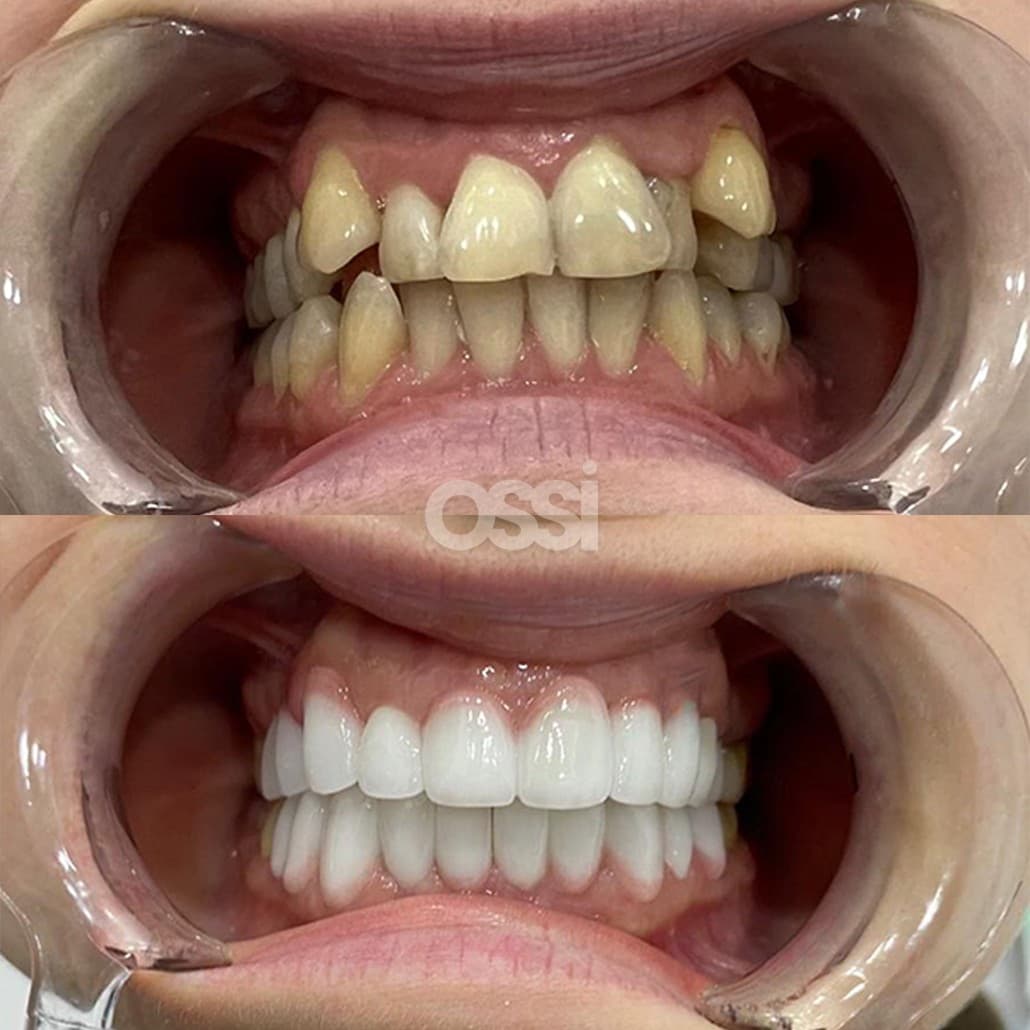 Dental Care Case 2