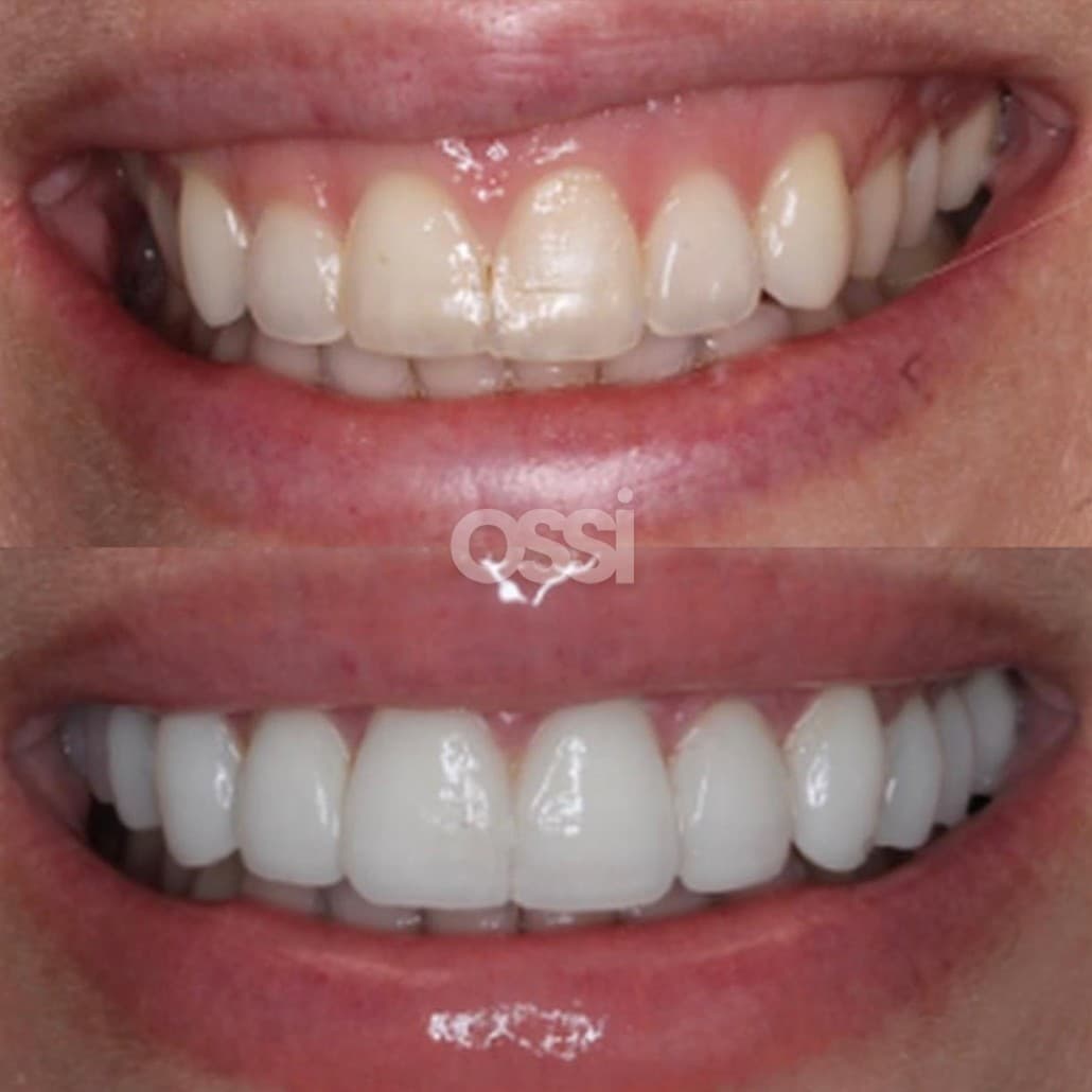 Dental Care Case 3