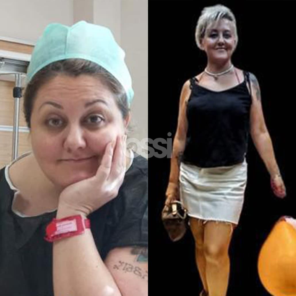 Obesity Surgery Case 3