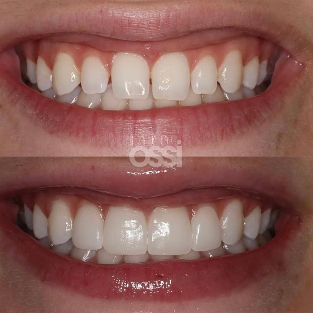 Dental Care Case 4
