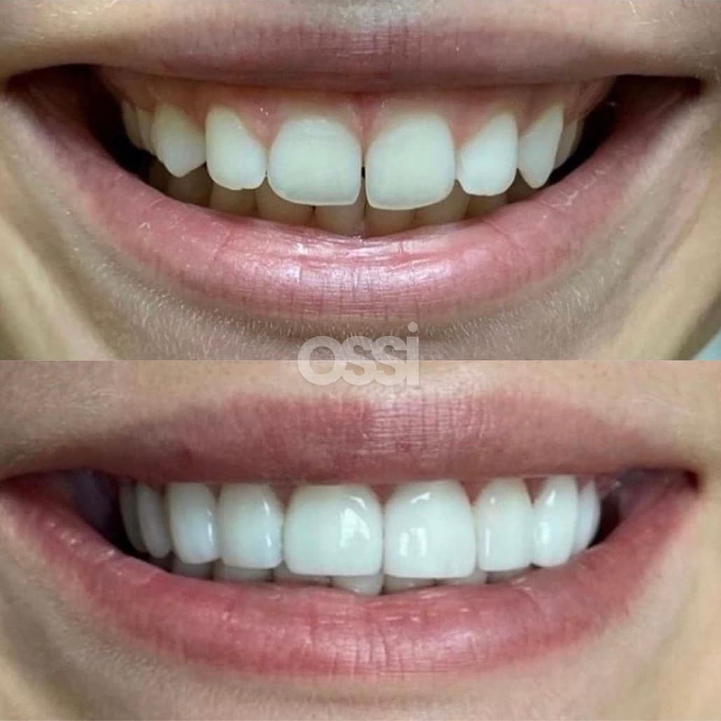 Dental Care Case 5