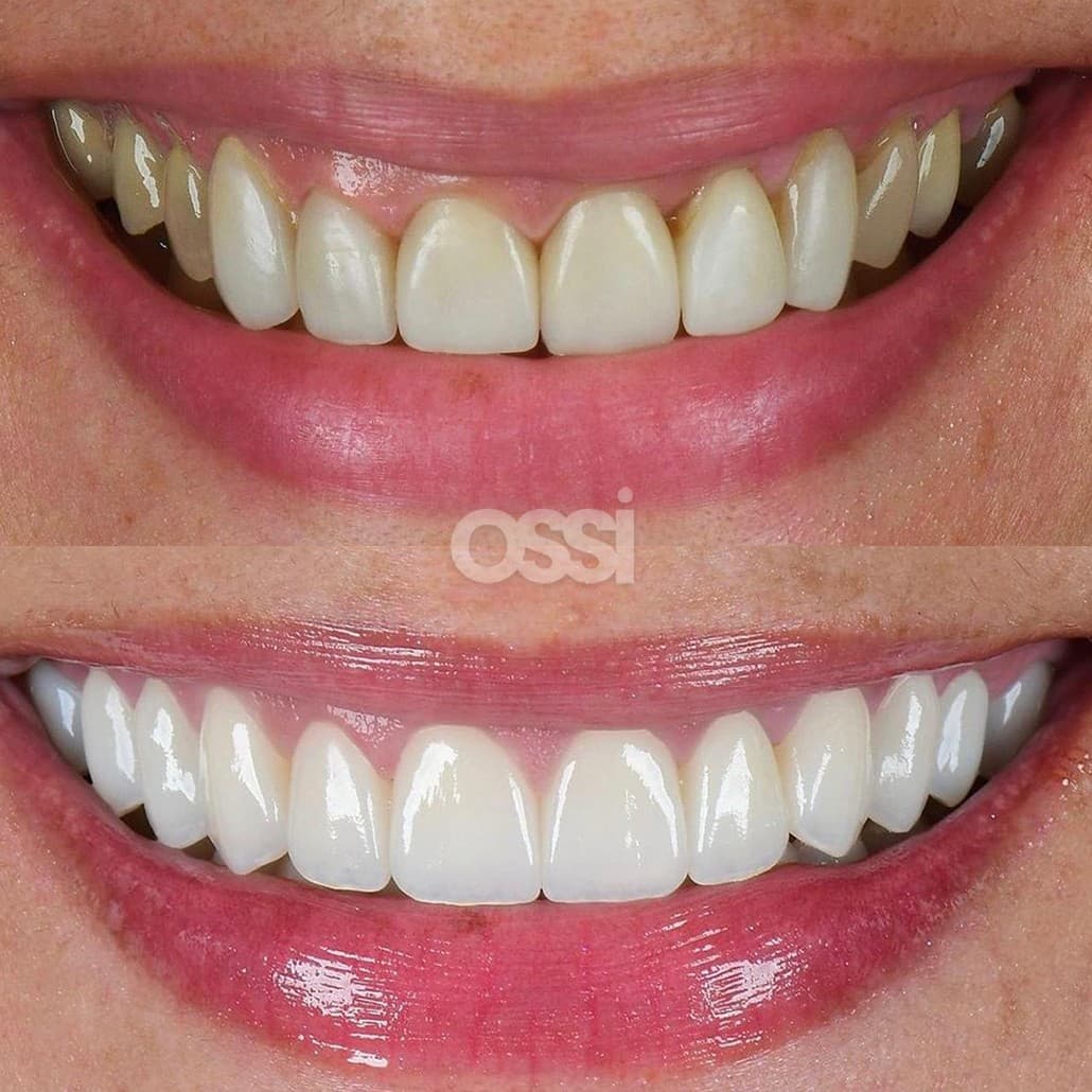 Dental Care Case 6