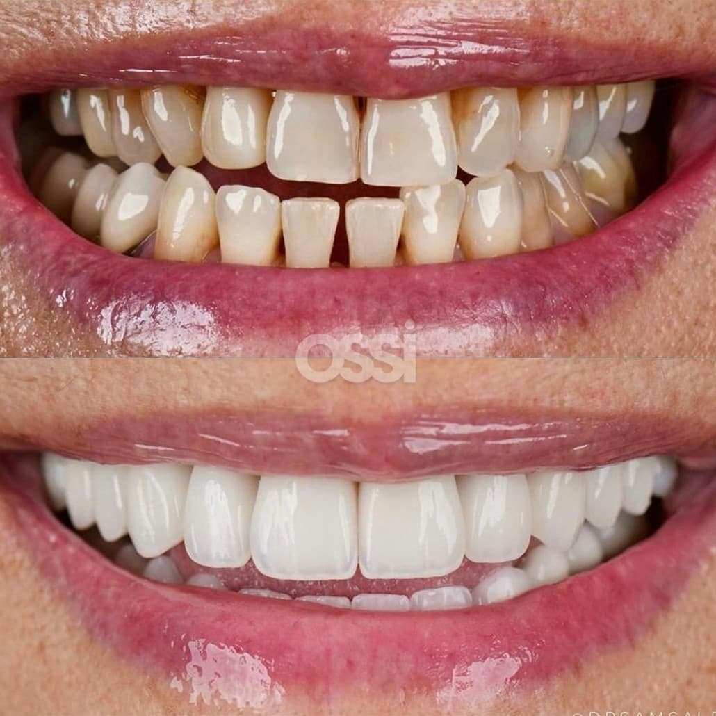 Dental Care Case 7