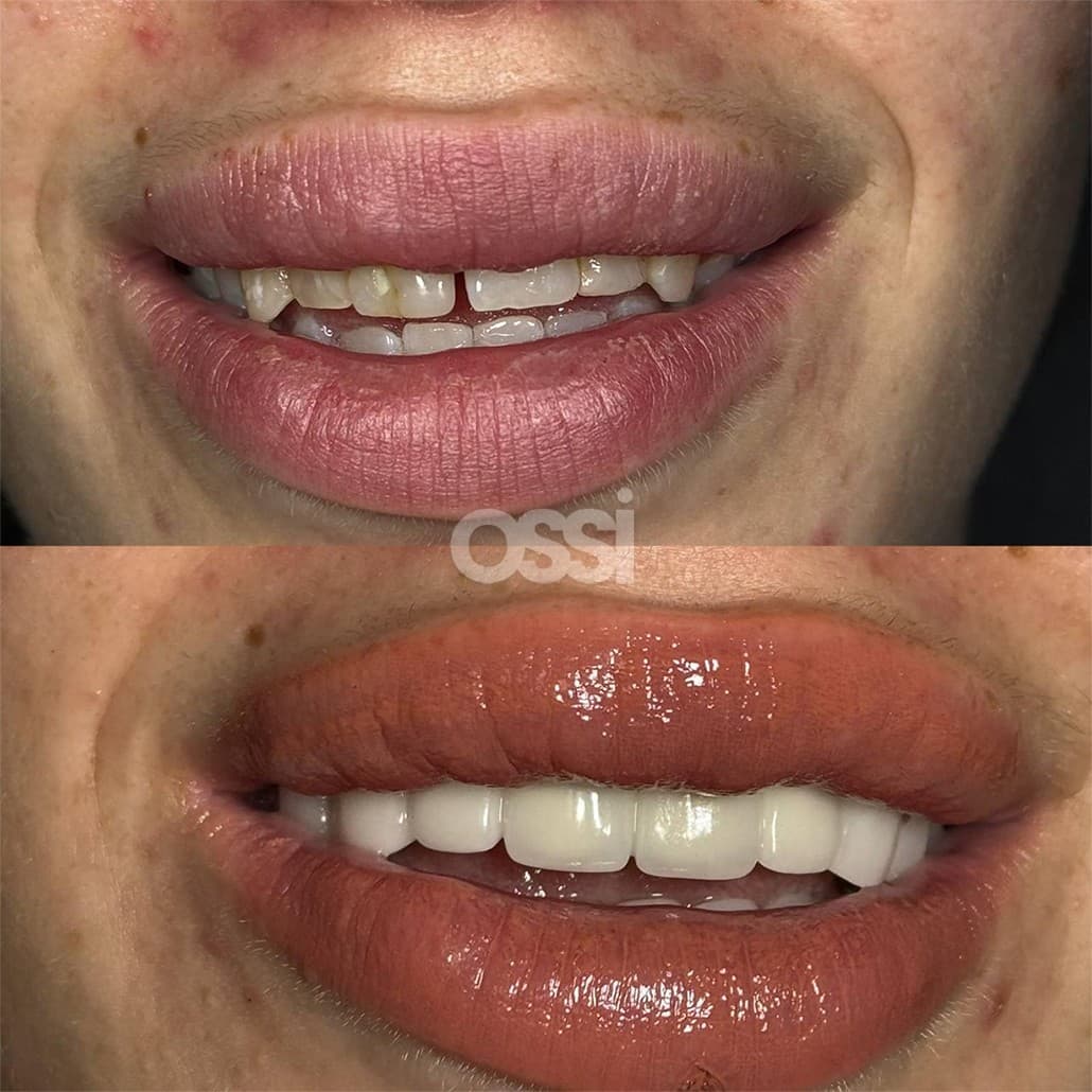 Dental Care Case 8