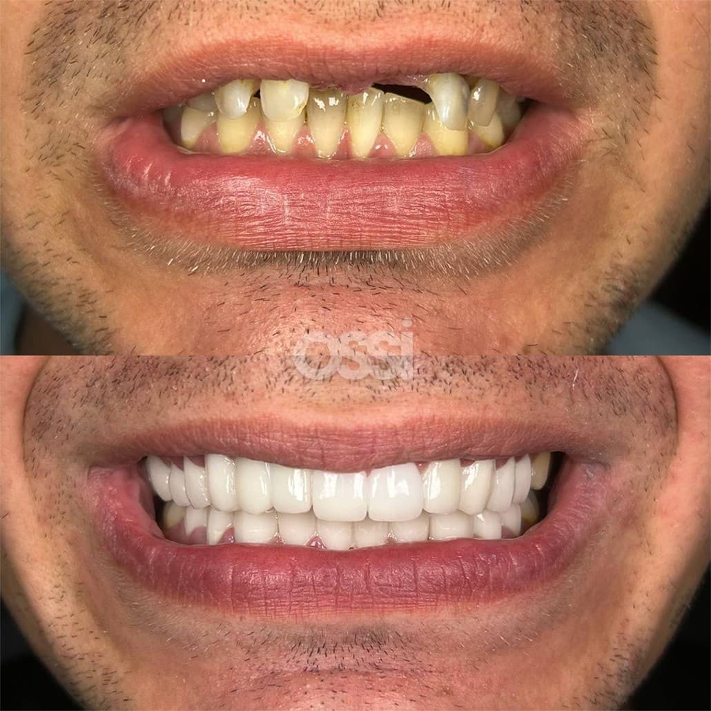 Dental Care Case 9